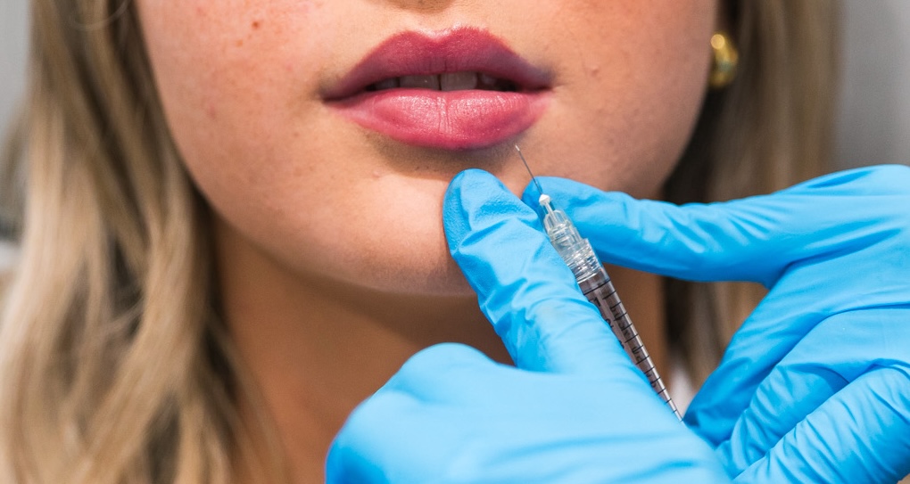  A provider's hands, in blue surgical gloves, holds a hypodermic below a patient's lower lip as they undergo enhancement with lip filler in Mansfield.