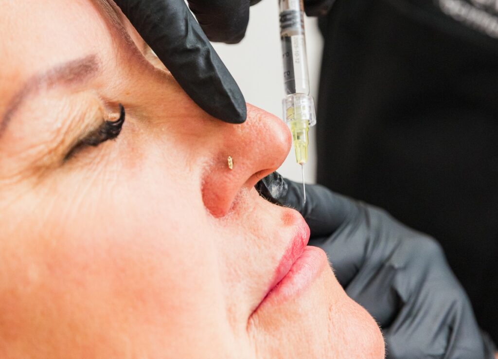  Close-up of a mature female patients face with a provider's hands holding a hypodermic needle pointed at her upper lip. She's about to receive lip filler near Ovilla.